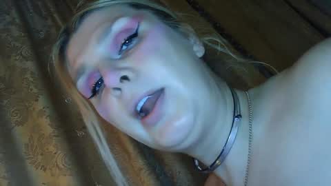 Annika  MTF ts post -op online show from 02/03/25, 02:13